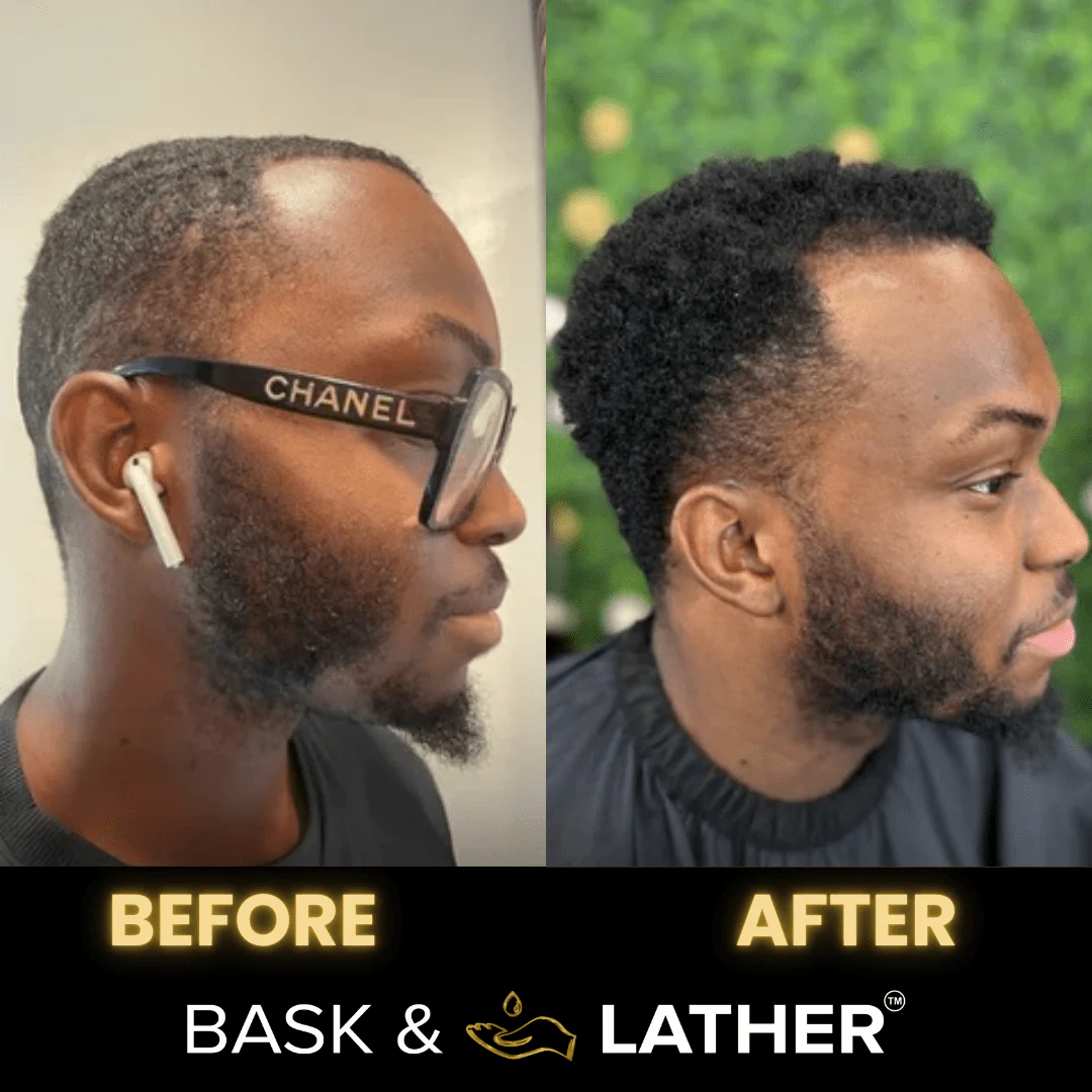 Beard Growth Bundle - Image 3