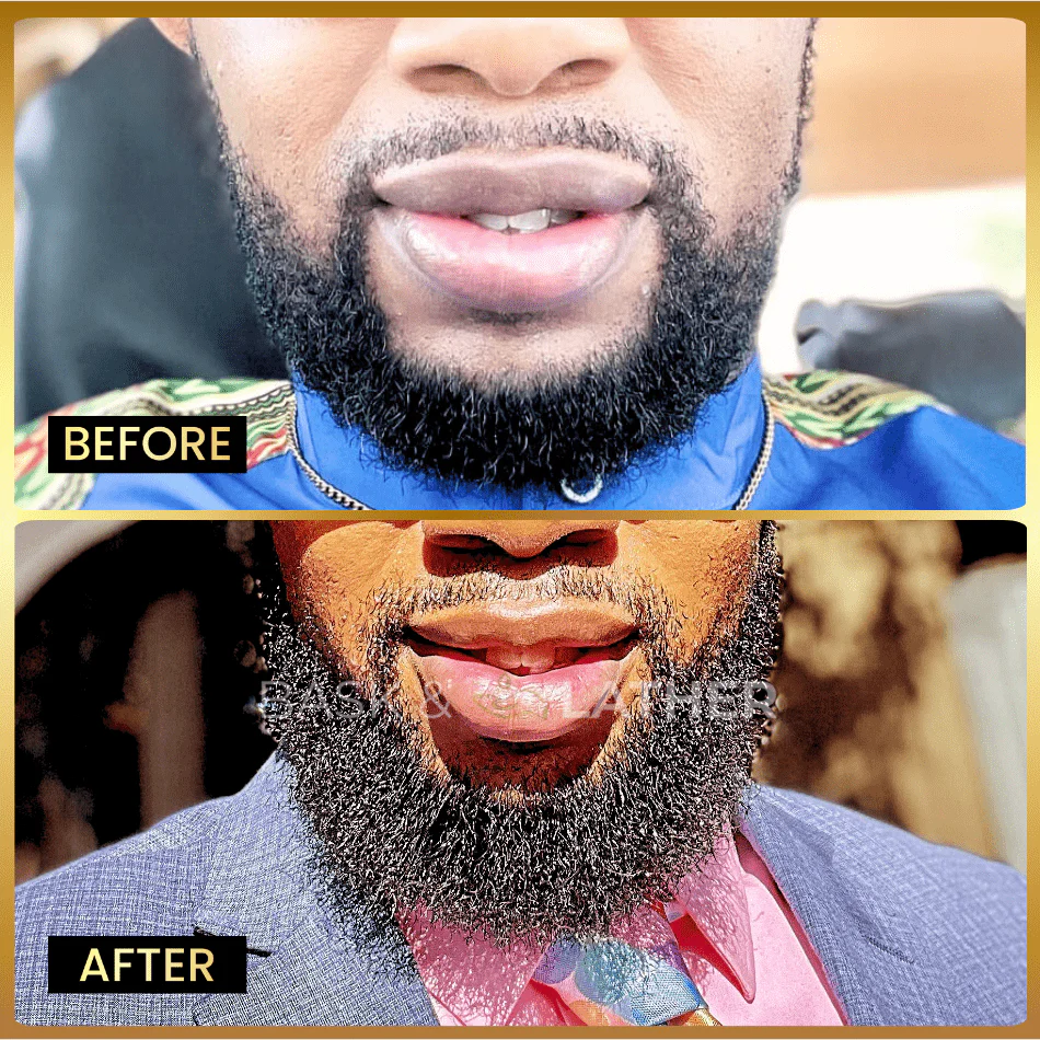 Beard Oil – Beard Softener & Growth Enhancer - Image 3
