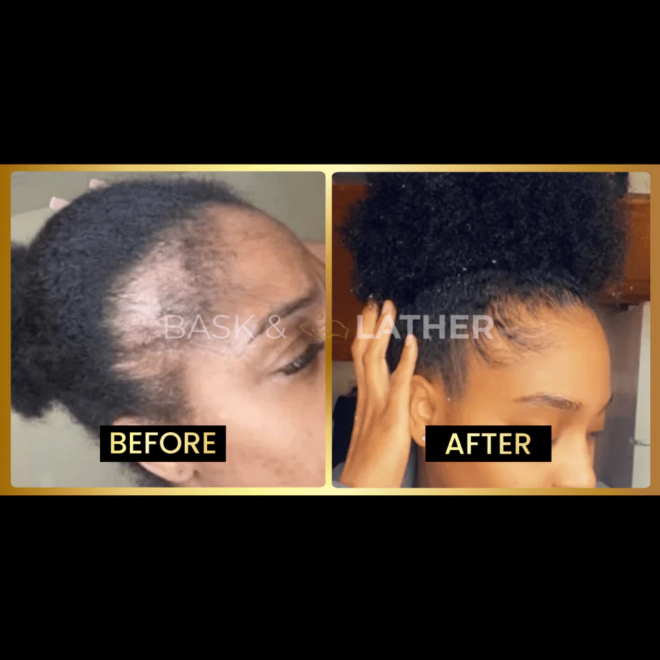 JUMBO Scalp Stimulator - Image 4