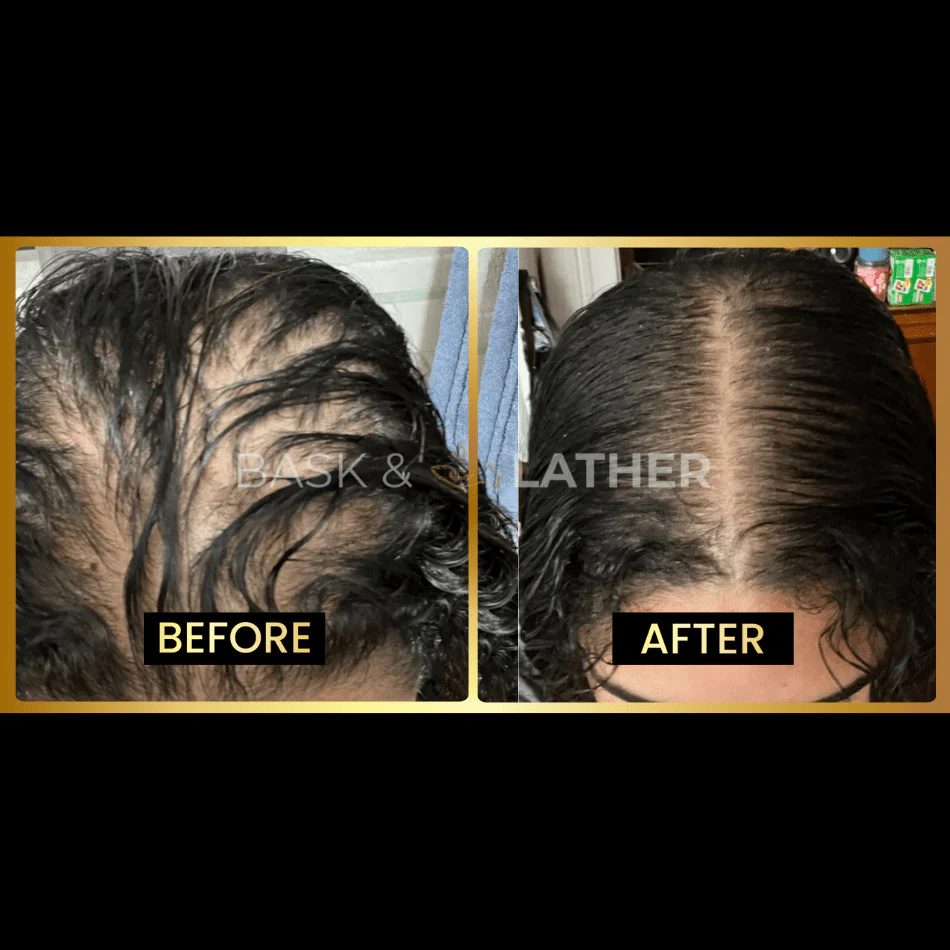 JUMBO Scalp Stimulator - Image 6