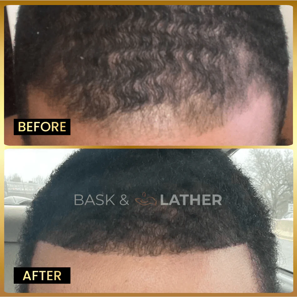 Men's Beard & Hair Growth Bundle - Image 3