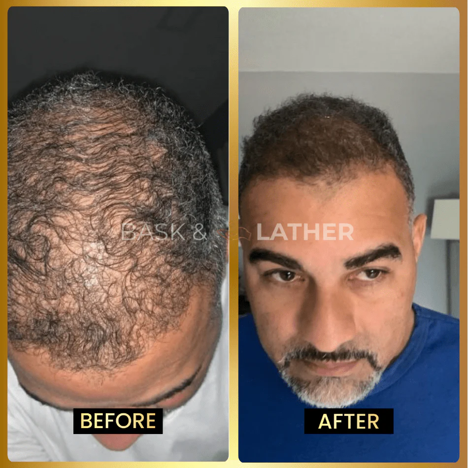 Men's Beard & Hair Growth Bundle - Image 4