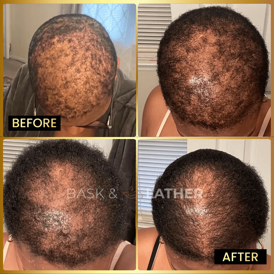 Men's Beard & Hair Growth Bundle - Image 5