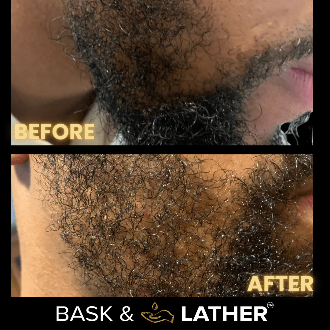 Beard Growth Magic (Beard Growth Oil) - Image 5