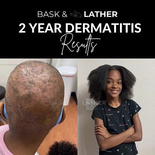 Nurture & Grow- Kids Healthy Hair Bundle - Image 3
