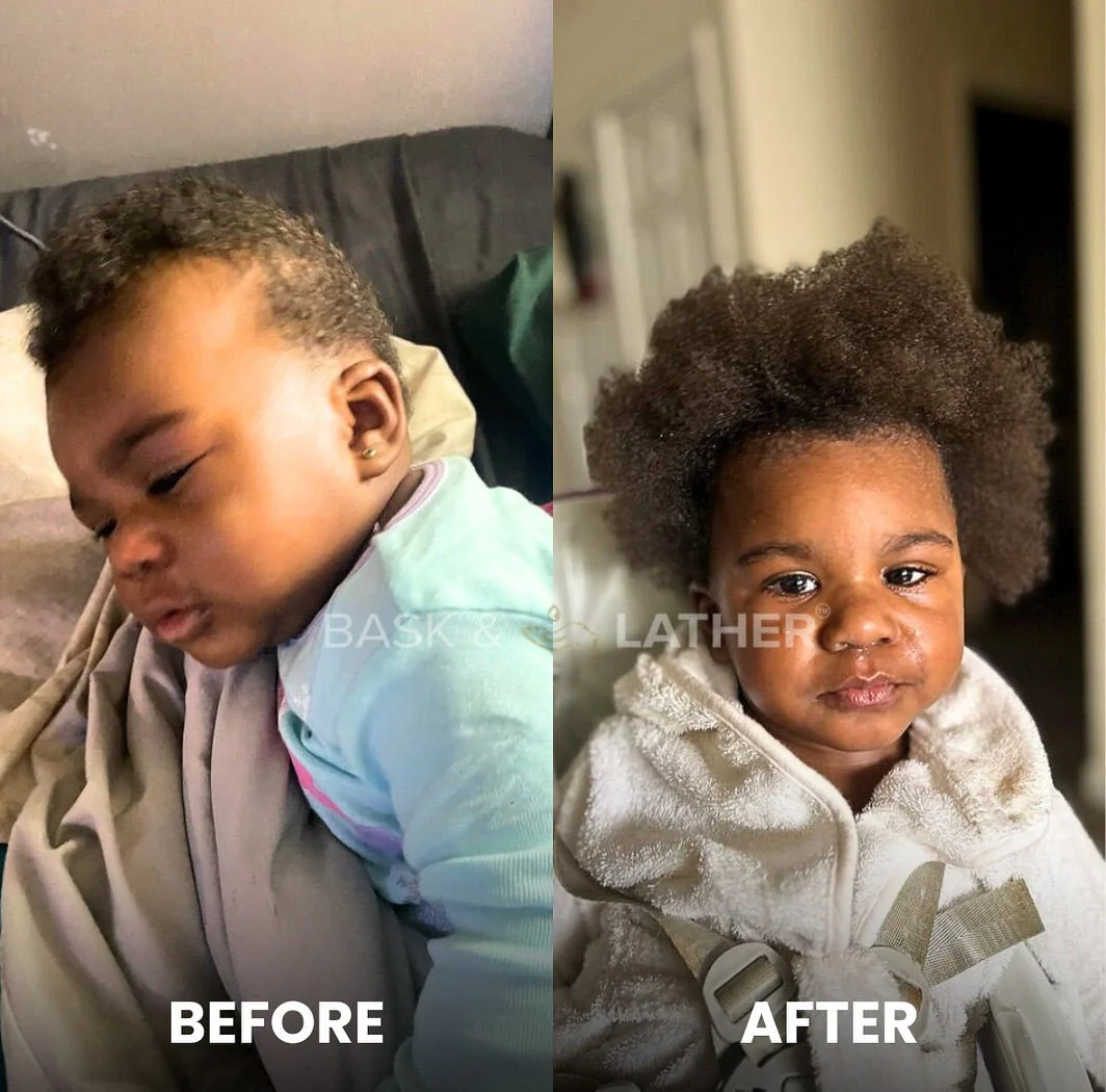 Nurture & Grow- Kids Healthy Hair Bundle - Image 4