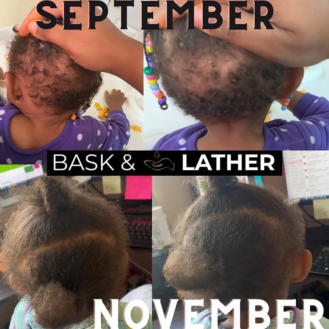 Nurture & Grow- Kids Healthy Hair Bundle - Image 5