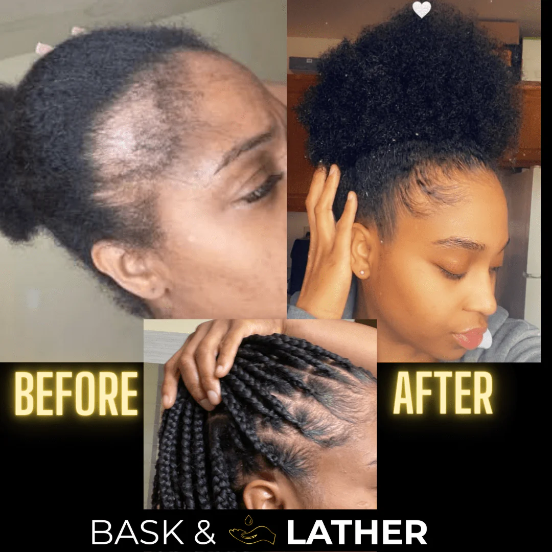 Scalp Stimulator | Hair Growth Oil - Image 4