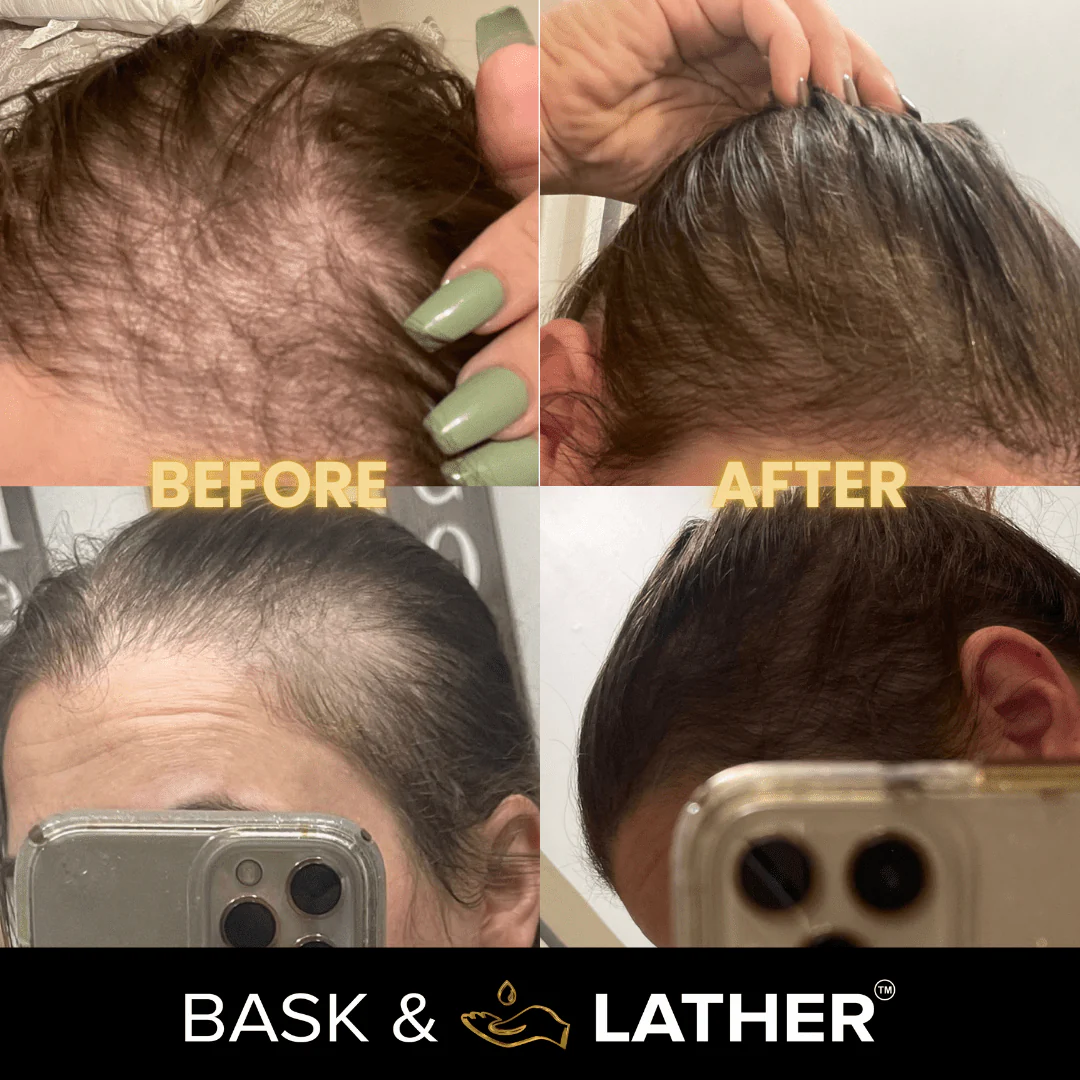 Scalp Stimulator | Hair Growth Oil - Image 5