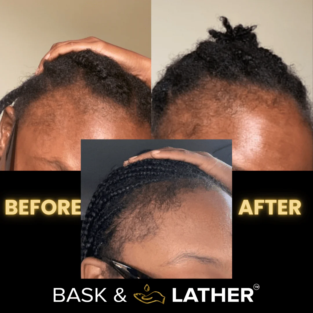 Scalp Stimulator | Hair Growth Oil - Image 6