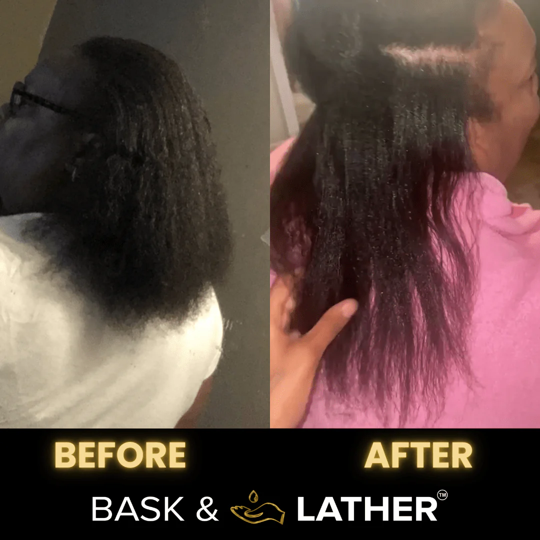 Scalp Stimulator | Hair Growth Oil - Image 7