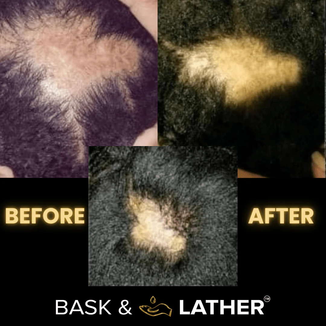 Scalp Stimulator | Hair Growth Oil - Image 8