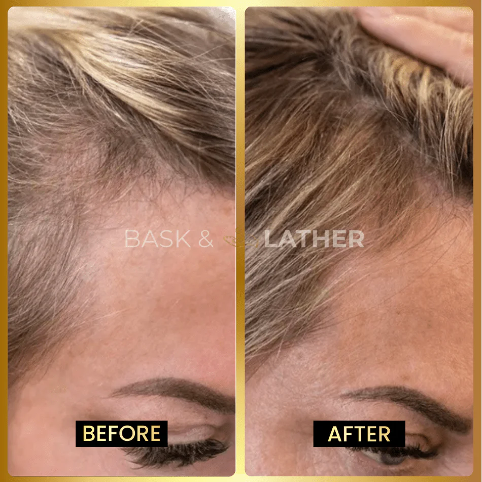 Growth & Length Retention Bundle - Image 5