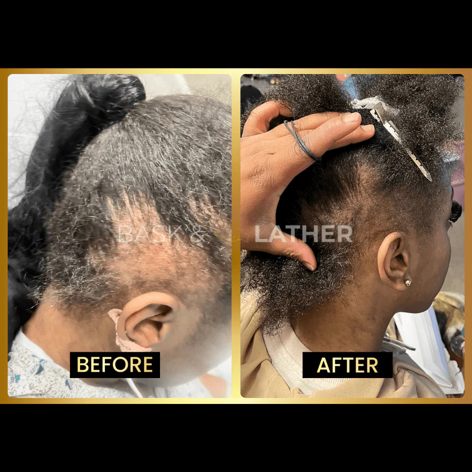 Growth & Length Retention Bundle - Image 6