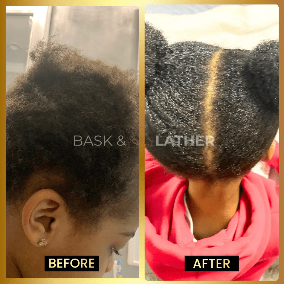 BALM- Stimulating Scalp and Hair Balm - Image 4