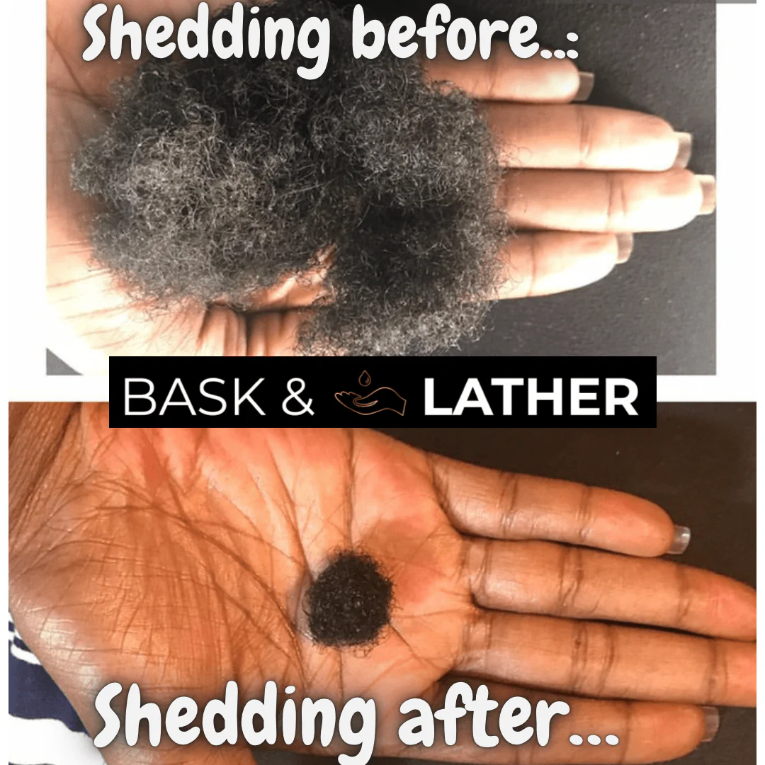 Healthy Hair Starter Kit- Limited Edition - Image 3