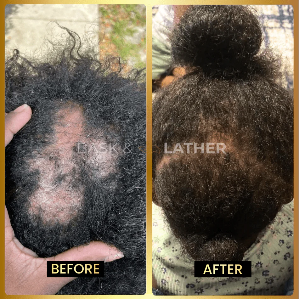 JUMBO Scalp Stimulator - Image 5